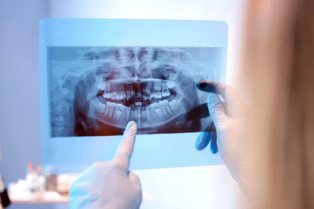 Digital Imaging Radiographs Img