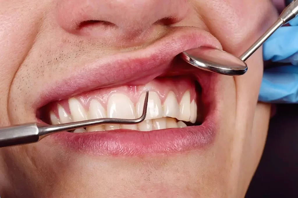 Periodontal Treatment Img