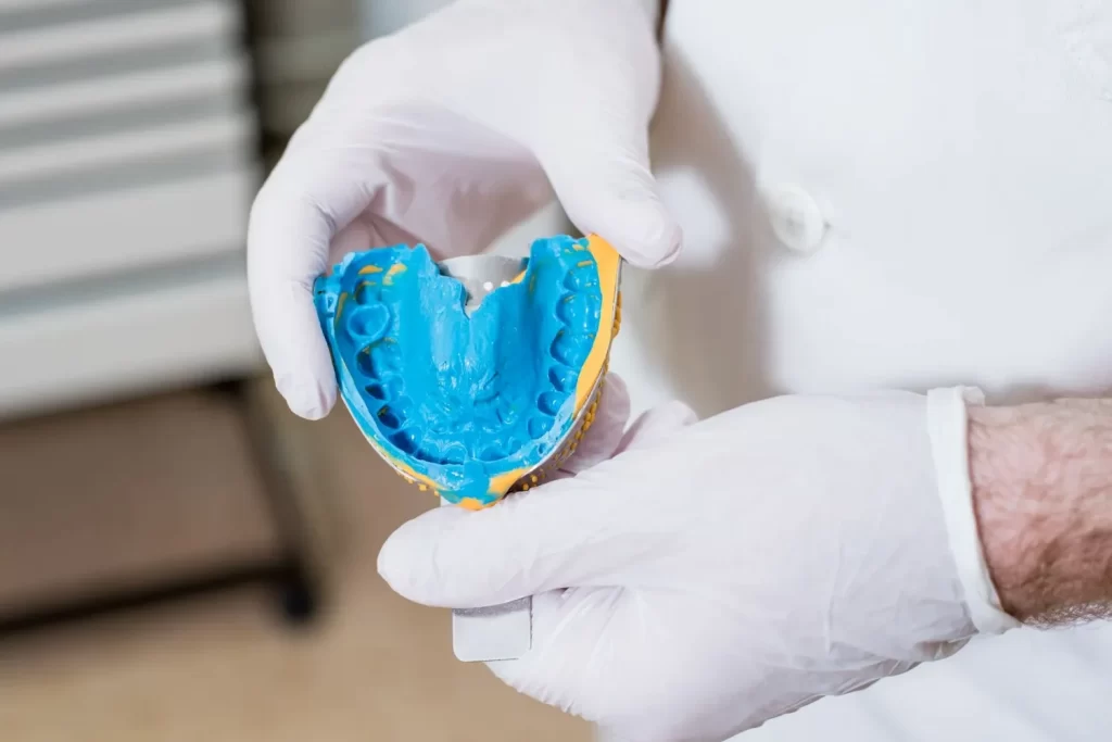 Denture Impression Appointment