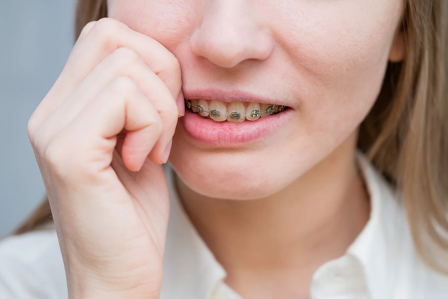 Orthodontic Emergencies
