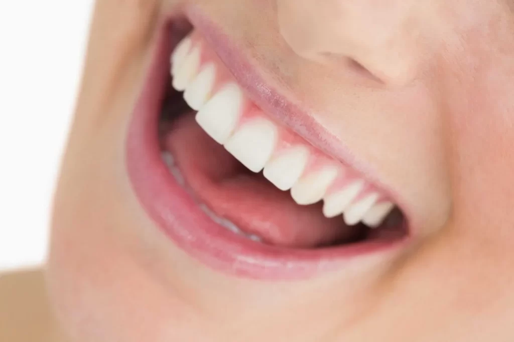 Smile Contouring Reshaping
